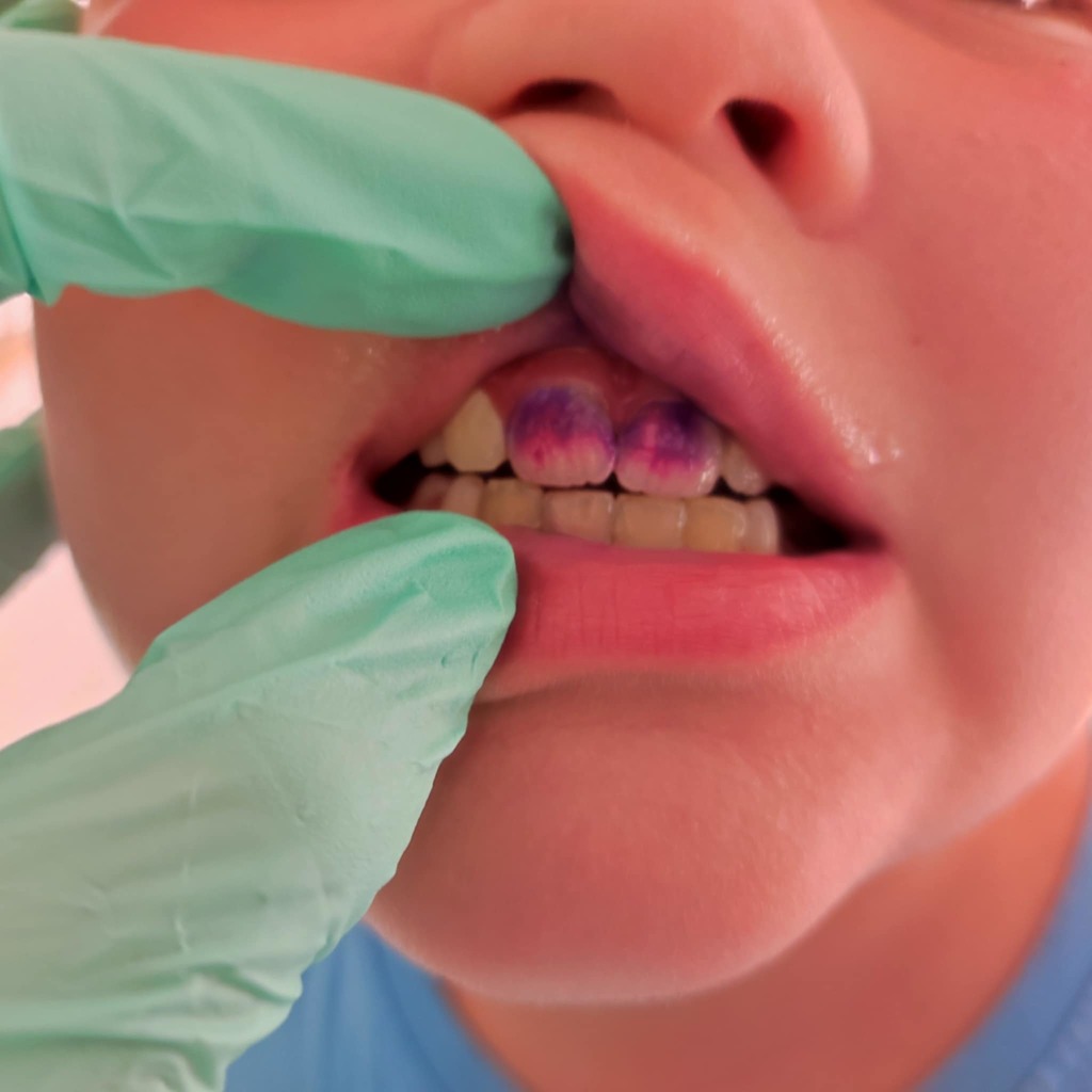 balatonfenyvesi tábor5